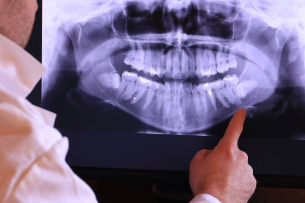 Best Emergency Dental Extractions in White Bluff, TN