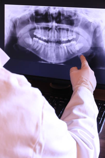 Best Emergency Dentist for Knocked-Out Tooth in White Bluff, TN