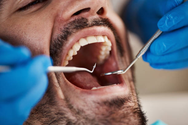 Best Pediatric Emergency Dentist in White Bluff, TN