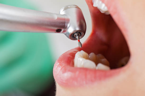 Best Emergency Dental Services for Seniors in White Bluff, TN